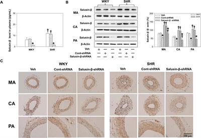 Improvement of Vascular Function by Knockdown of Salusin-β in Hypertensive Rats via Nitric Oxide and Reactive Oxygen Species Signaling Pathway